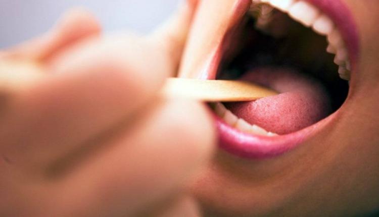 بررسی ارتباط  میان سرطان گلو و سکس دهانی در افراد